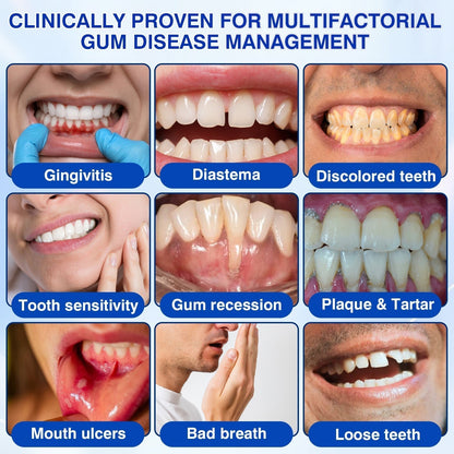 👨‍⚕️🦷🛡️BBOJI®GumRevive Periodontal Repair Gel