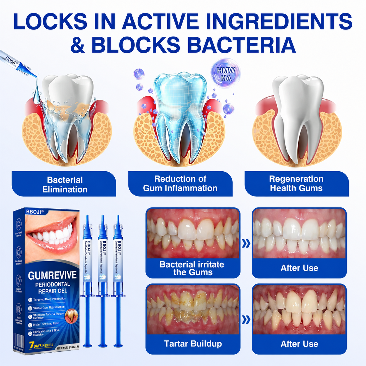 👨‍⚕️🦷🛡️BBOJI®GumRevive Periodontal Repair Gel